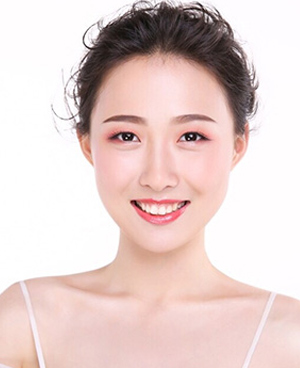 李佳琪